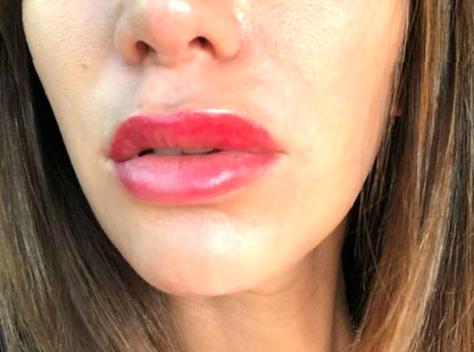 Tips for Fixing Lip Blush Mistakes