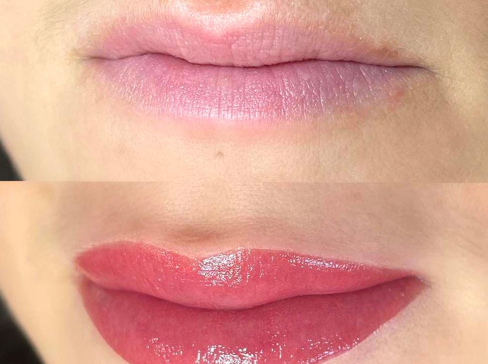Strategies to Avoid Lip Blush Issues
