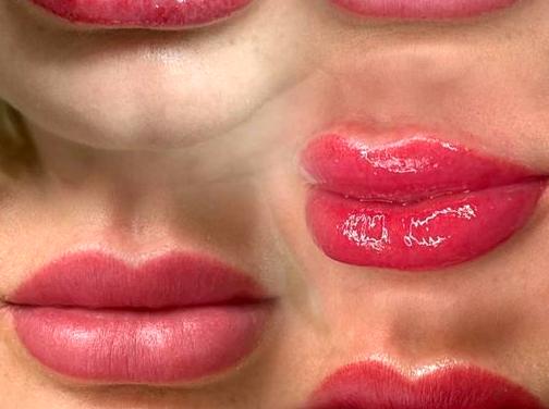 How to Resolve Common Lip Blush Problems