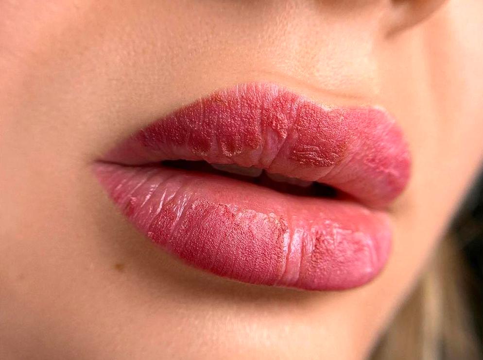 Preventative Measures for Lip Blush Missteps